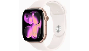 Apple Watch Series 11 46mm Розовое золото/алюминиевый корпус
